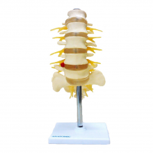 Modelo Anatômico da Coluna Lombar Anatomic
